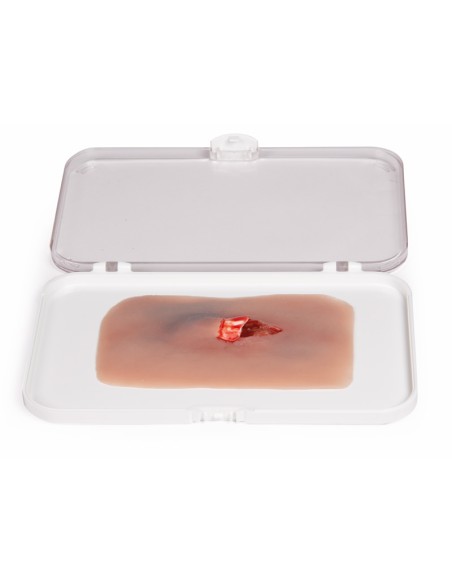 Moulage und Simulation einer freiliegenden Frakturwunde Erler Zimmer NW004