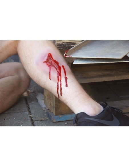 Moulage and simulation of laceration wound Erler Zimmer NW003