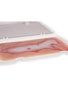 Moulage e simulazione di ferita da scottatura Erler...