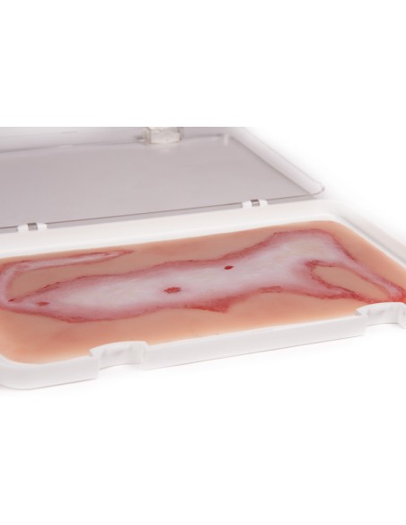 Moulage y simulación de herida escaldada Erler Zimmer NW108