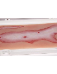 Moulage e simulazione di ferita da scottatura Erler... 2