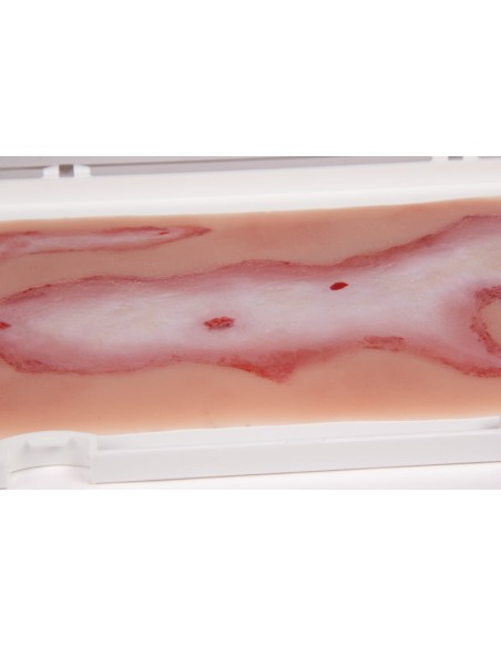 Moulage et simulation de blessures par ébouillantage Erler Zimmer NW108