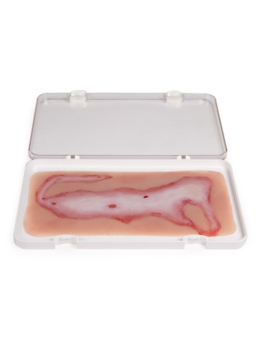 Moulage et simulation de blessures par...