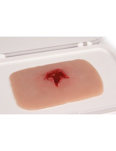 Moulage and simulation of exit wound from a firearm Erler... 2