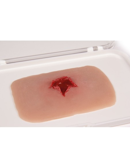 Moulage und Simulation der Austrittswunde aus einer Schusswaffe Erler Zimmer NW010B