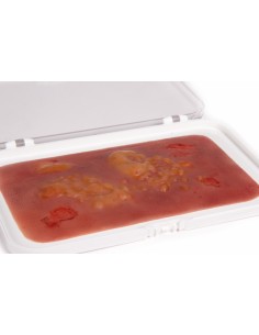 Moulage and simulation of second-degree burn wound Erler...