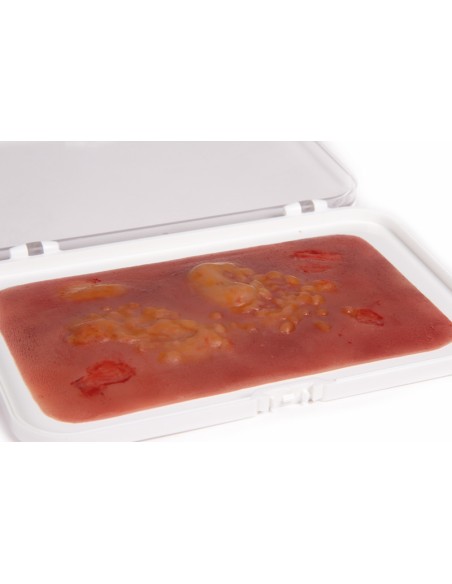 Moulage und Simulation einer Verbrennungswunde zweiten Grades Erler Zimmer NW007
