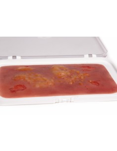 Moulage and simulation of second-degree burn wound Erler... 2