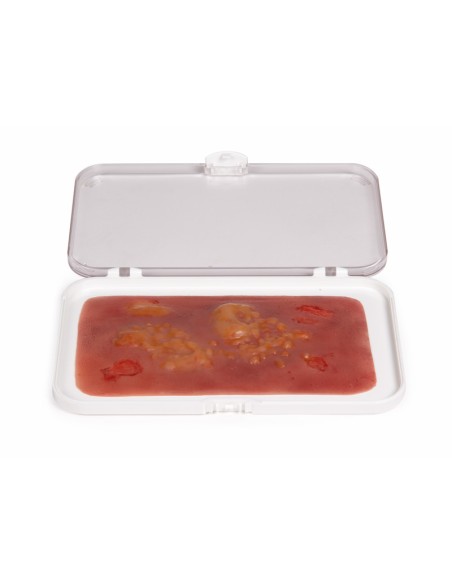 Moulage and simulation of second-degree burn wound Erler Zimmer NW007