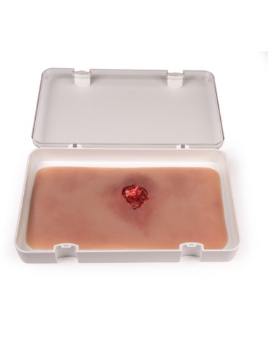 Moulage and simulation of arm wound with...