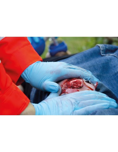 Moulage and simulation of leg wound with...