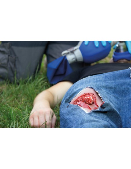 Moulage et simulation d'une plaie de jambe avec fracture exposée et fonction de saignement Erler Zimmer NW103