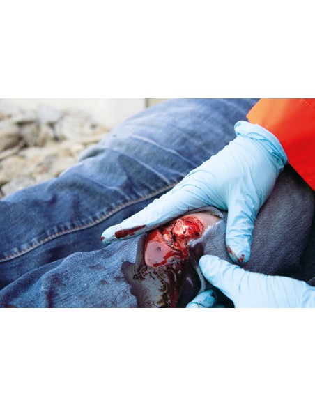 Moulage and simulation of leg wound with exposed fracture and bleeding function Erler Zimmer NW103