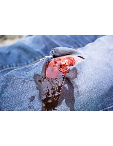 Moulage and simulation of leg wound with...