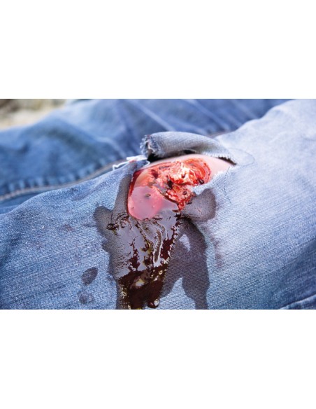 Moulage and simulation of leg wound with exposed fracture and bleeding function Erler Zimmer NW103