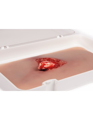 Moulage et simulation d'une plaie de jambe avec...