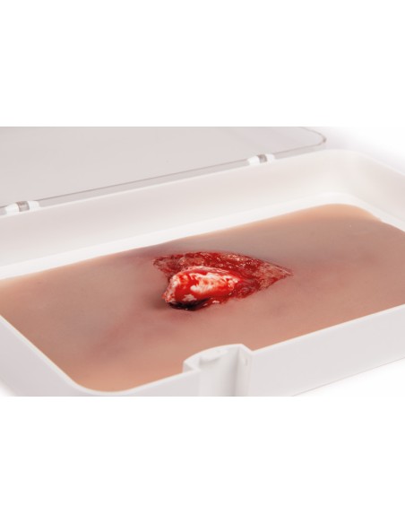 Moulage y simulación de herida de pierna con fractura expuesta y función hemorrágica Erler Zimmer NW103