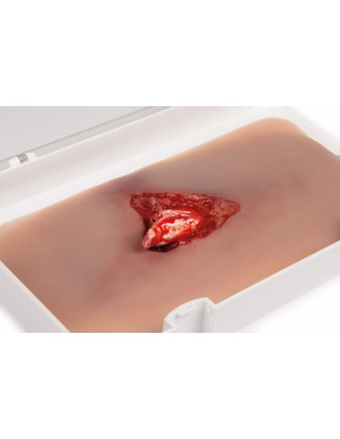 Moulage e simulazione di ferita della gamba con...