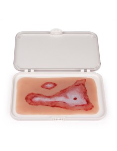 Moulage and scald wound simulation Erler Zimmer NW011 2