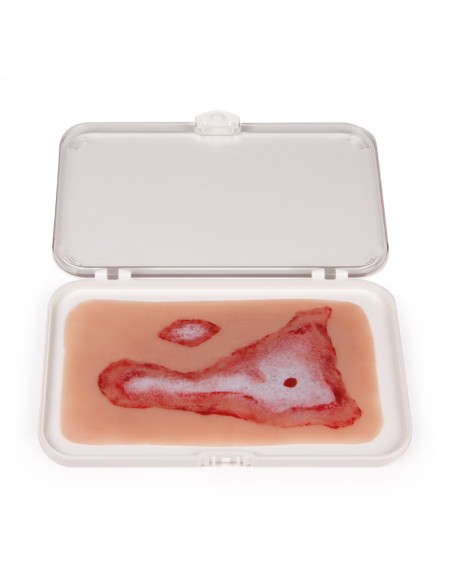 Moulage and scald wound simulation Erler Zimmer NW011