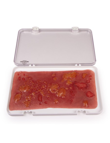 Moulage et simulation de brûlure au deuxième degré Erler Zimmer NW106