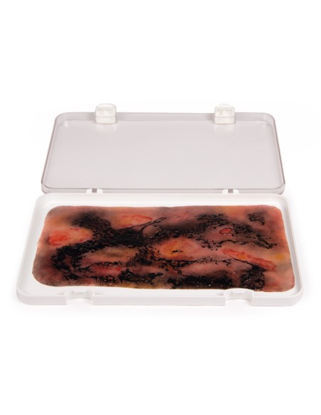 Moulage and simulation of third-degree burn Erler Zimmer NW107