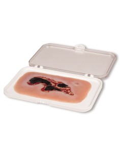 Moulage of lower limb arterial ulcer wound, small,...