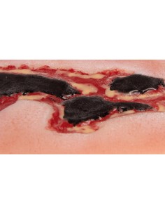 Moulage of lower limb arterial ulcer wound, small,... 2