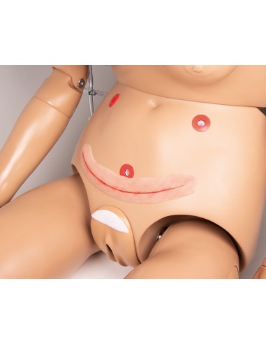 Chirurgische Wundmoulage ohne Naht, 22cm (für...