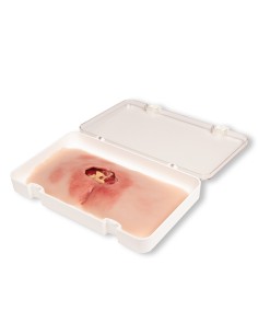 Moulage of clean sacral decubitus ulcer PW001B