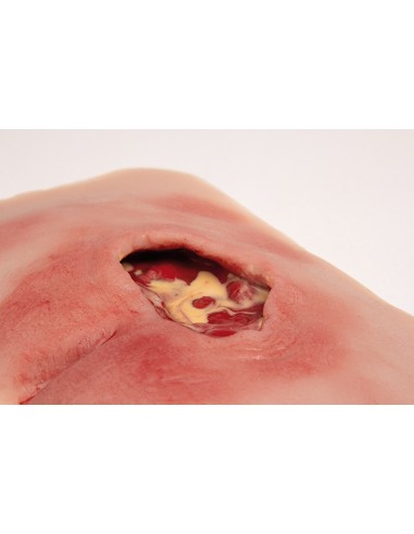 Moulage de úlcera de decúbito sacra limpia PW001B