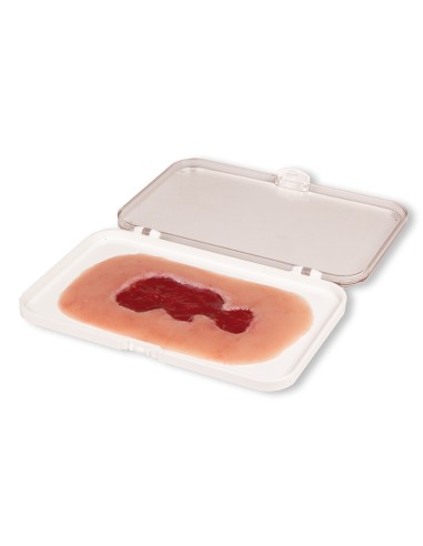 Moulage d'un ulcère veineux de jambe, petit, granulant Erler Zimmer PW002B