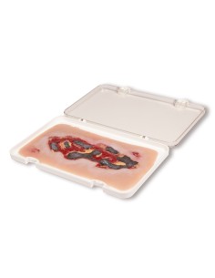 Moulage of lower limb arterial ulcer wound, large,...