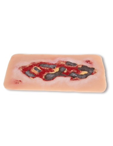 Moulage de herida de úlcera de miembro...