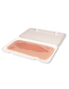 Moulage eines Ulkus der unteren Extremitäten, groß,...