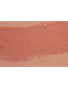 Moulage de herida de úlcera de miembro inferior, grande,... 2