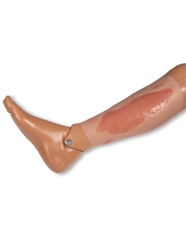 Moulage de herida de úlcera de miembro...