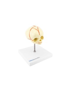Skull of fetus on easel at dimension i royals 2