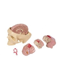 Anatomical model of diseases of the brain, erler zimmer 4525