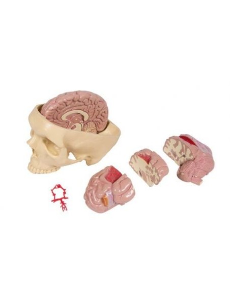 Anatomical model of diseases of the brain, erler zimmer 4525
