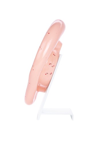 Modèle d'oreille d'acupuncture agrandi