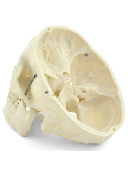 3-part white skull model with removable teeth