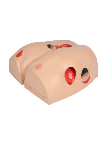 EZ-7600 pressure ulcer simulator