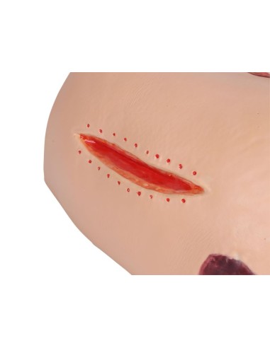 EZ-7600 pressure ulcer simulator