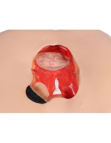 EZ-7600 pressure ulcer simulator