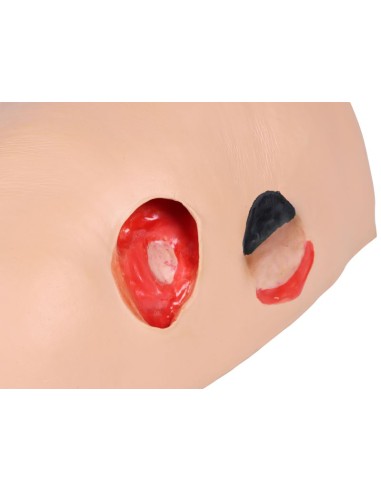 EZ-7600 pressure ulcer simulator