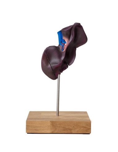 Modelo comparativo de la estructura hepática...