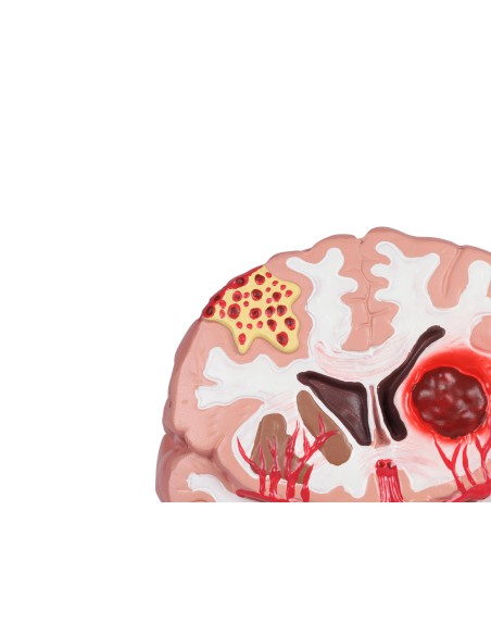 Patologie del cervello umano Erler Zimmer C711