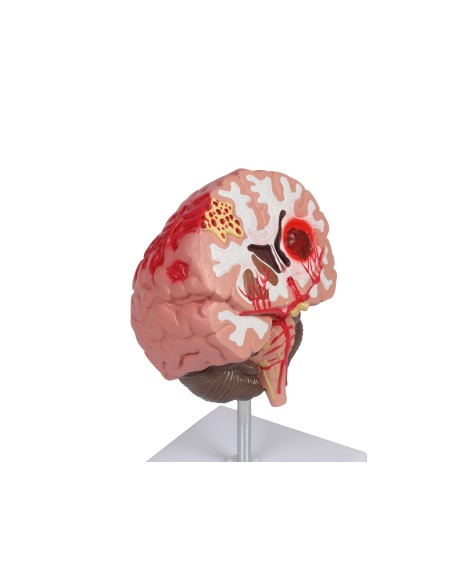 Pathologien des menschlichen Gehirns Erler Zimmer C711