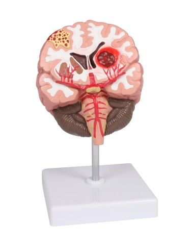 Pathologies du cerveau humain Erler Zimmer C711